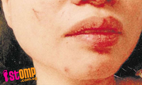 Name:  motherinlaw_beats_woman_for_an_hour_with_broom-thumbnail.jpg
              Views: 0
              Size:  59.3 KB