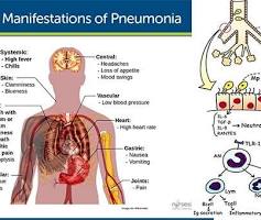 Pathogenesis and Clinical Manifestations of Mycoplasma pneumoniae