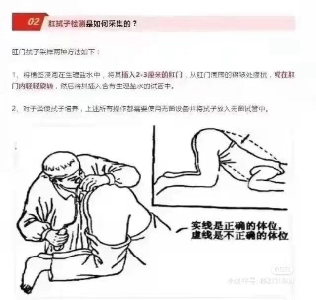 anus.jpg