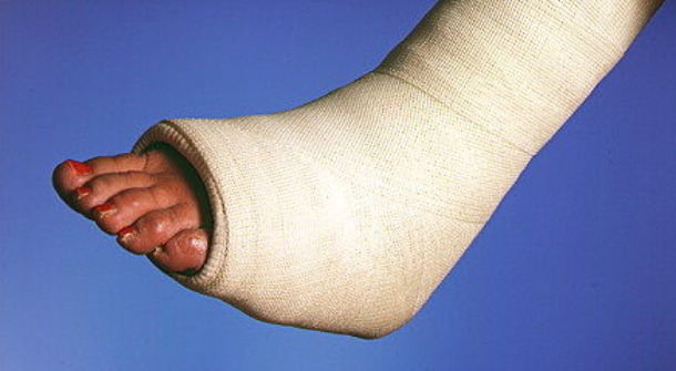 article_im1179_cast.jpg