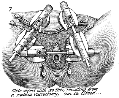chap10sec24image7.jpg