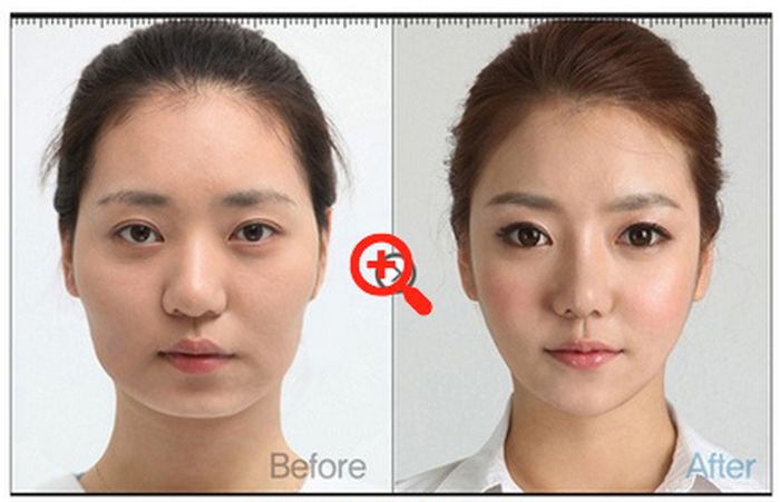 crazy_before_and_after_photos_of_korean_plastic_25.jpg