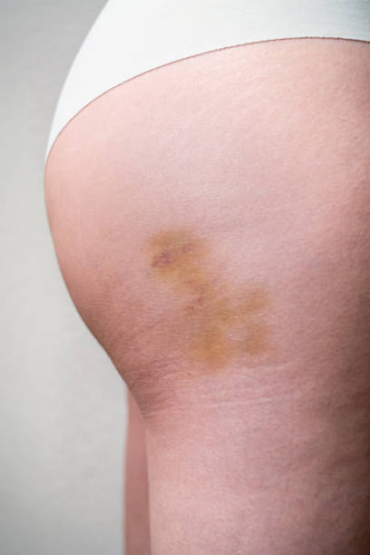 istockphoto-1203993428-612x612.jpg