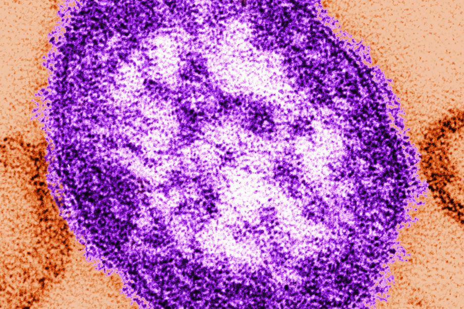 Measles.jpg