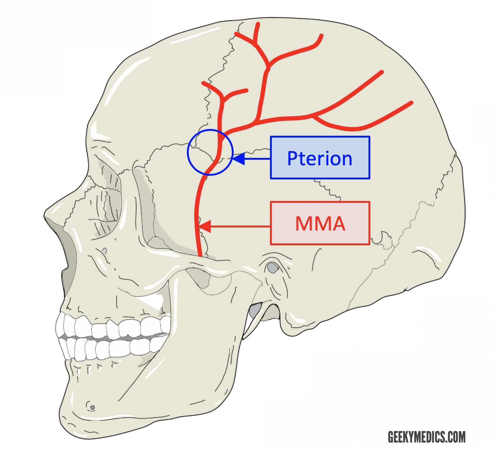 Middle-Meningeal-Artery-and-Pterion.jpg