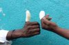 fingers_injured_ficon_0155.jpg
