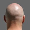 bald-head.jpg