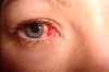 sad eyes.jpeg