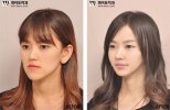 crazy_before_and_after_photos_of_korean_plastic_11.jpg