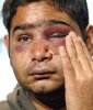 Bashed-student-6026329.jpg Bashed-student-6026329.jpg