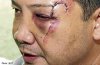 20121208_155851_surgeon.jpg 20121208_155851_surgeon.jpg
