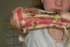 Krokodil-Drugs.jpg